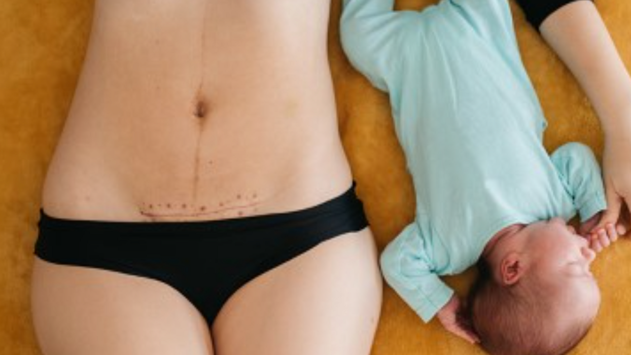 Post natal physical therapy